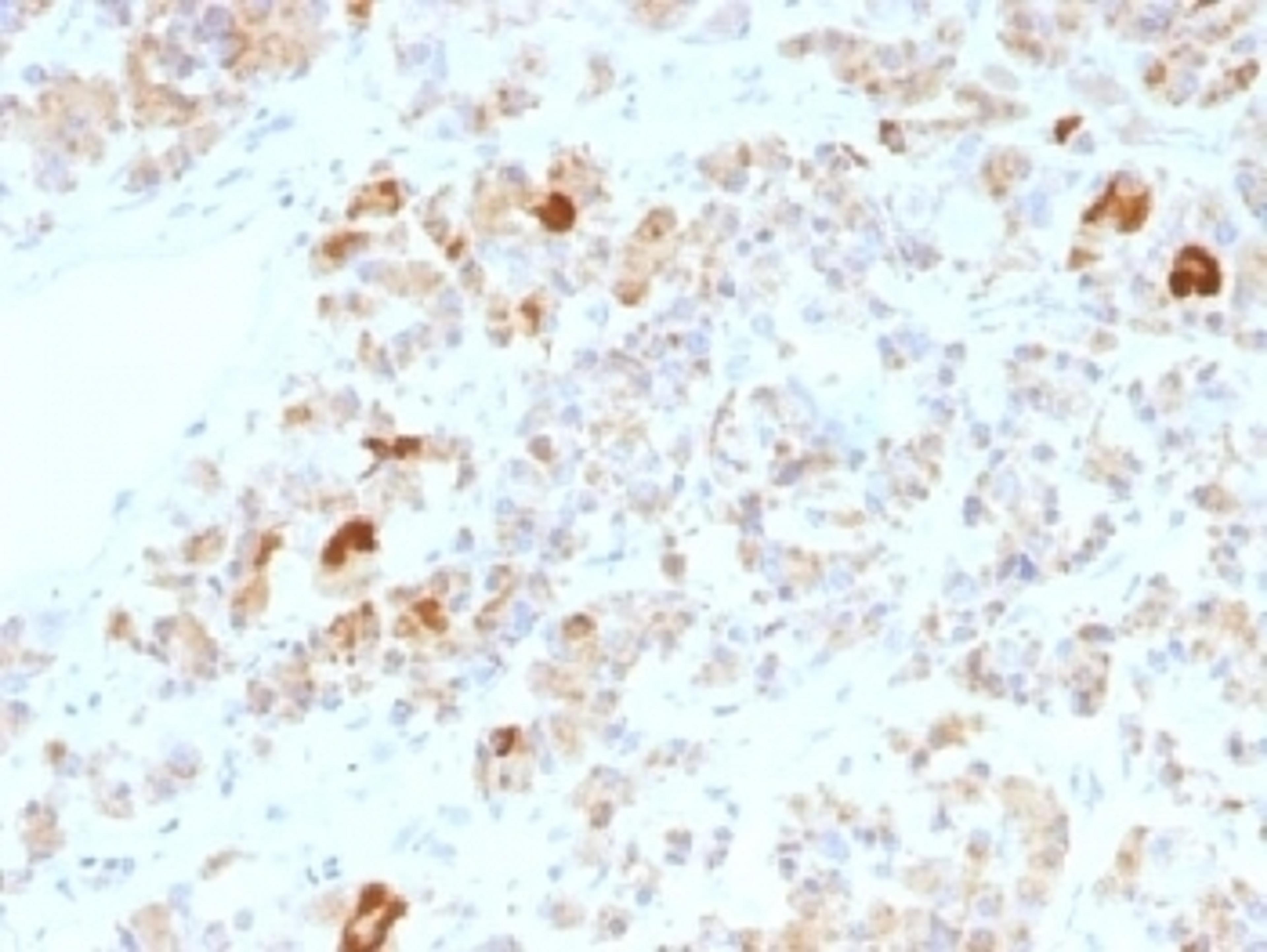 IHC testing of FFPE human pituitary gland stained with Luteinizing Hormone alpha antibody (clone LHa/756). No HIER required.