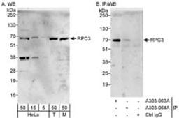 Detection of human and mouse RPC3 by western blot (h&m) and immunoprecipitation (h).