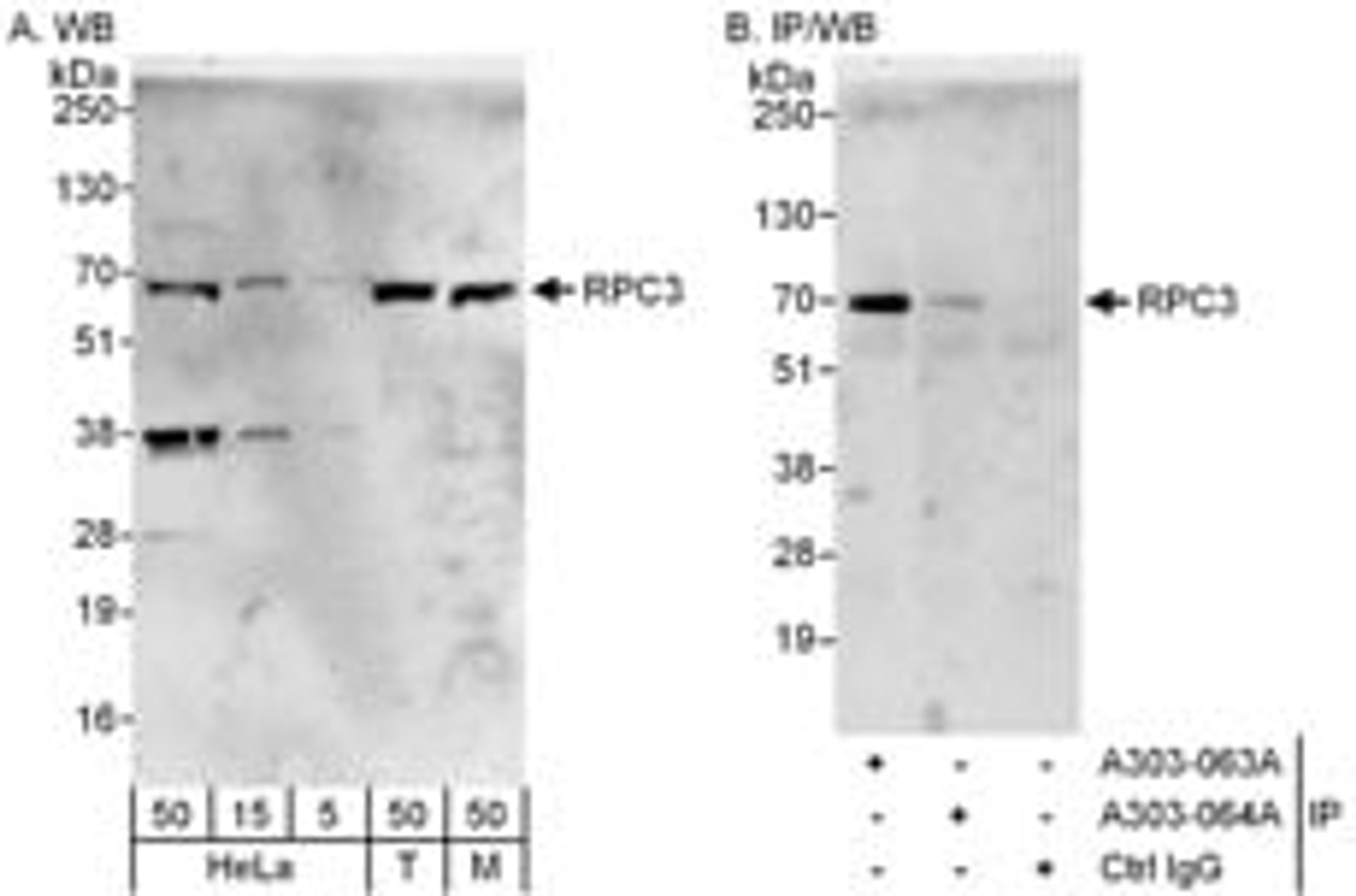 Detection of human and mouse RPC3 by western blot (h&m) and immunoprecipitation (h).