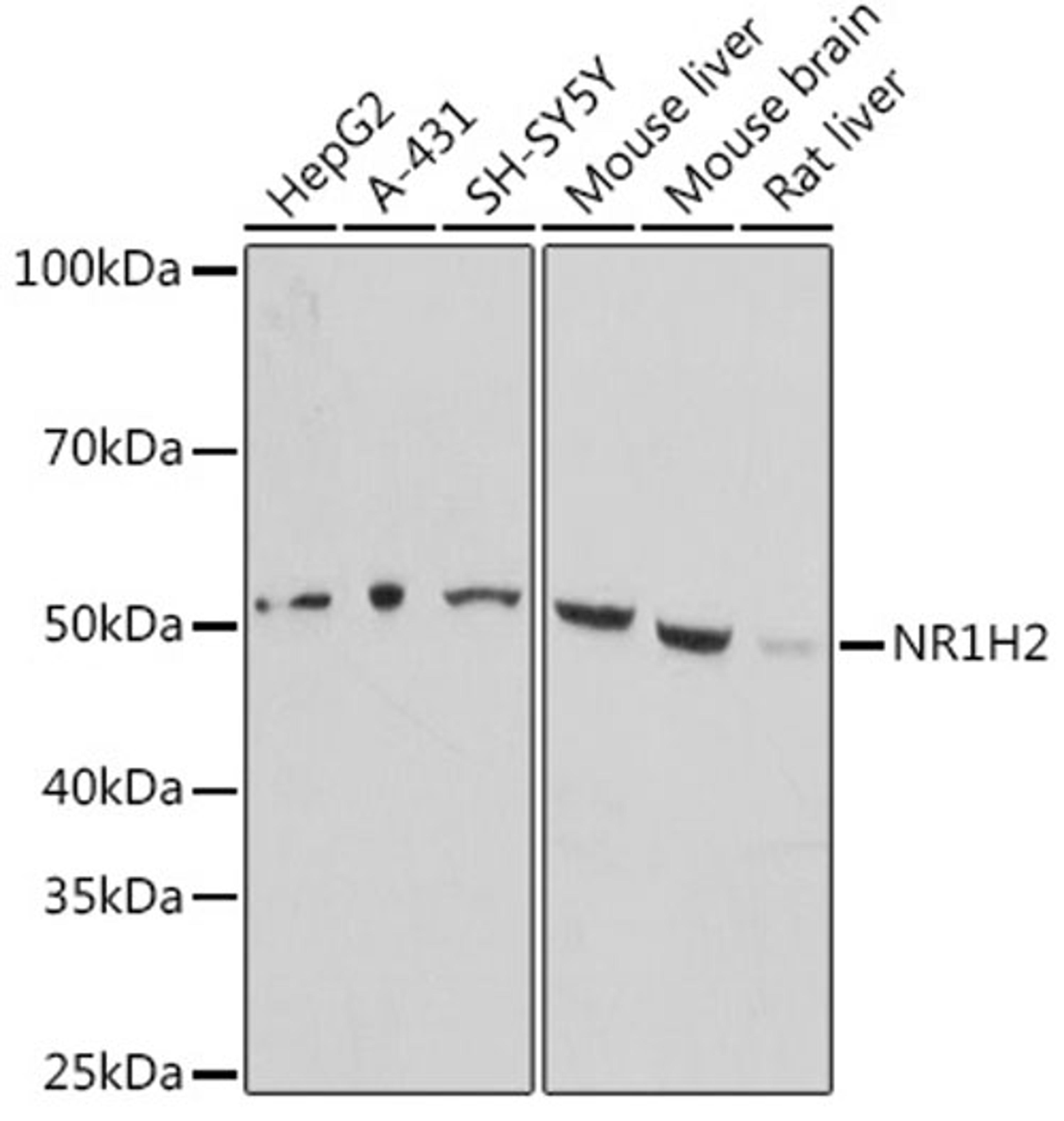 Western blot - NR1H2 antibody (A16291)