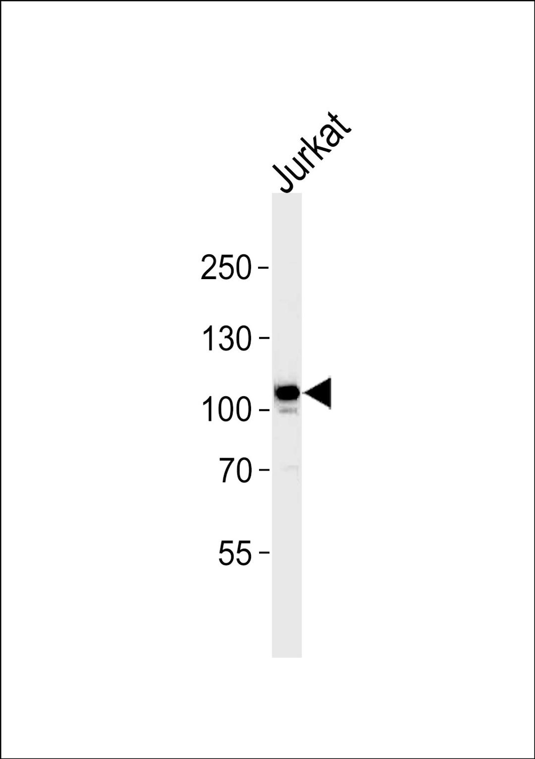 Western blot analysis in Jurkat cell line lysates (35ug/lane).