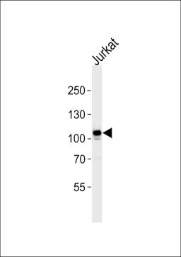 Western blot analysis in Jurkat cell line lysates (35ug/lane).