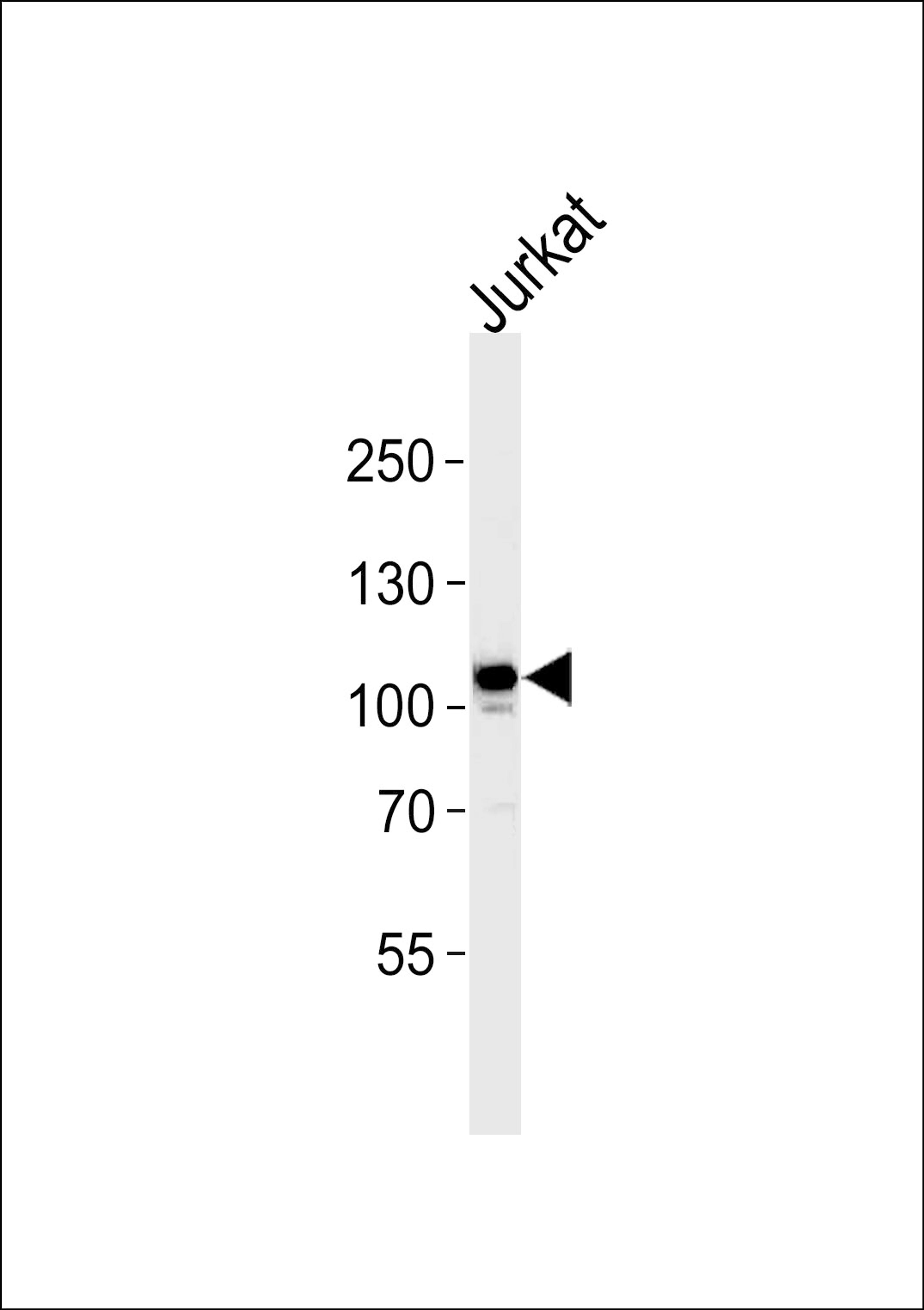 Western blot analysis in Jurkat cell line lysates (35ug/lane).