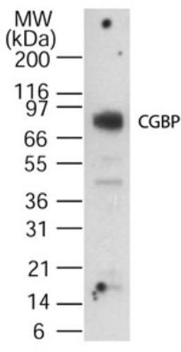 Western Blot: CXXC1 Antibody [NB100-56630] - analysis at 1:1,000 dilution against 15 ug/lane of human spleen lysate. Immunoreactivity was determined using SuperSignal system (Pierce) and by exposing to the film for 15 minutes.