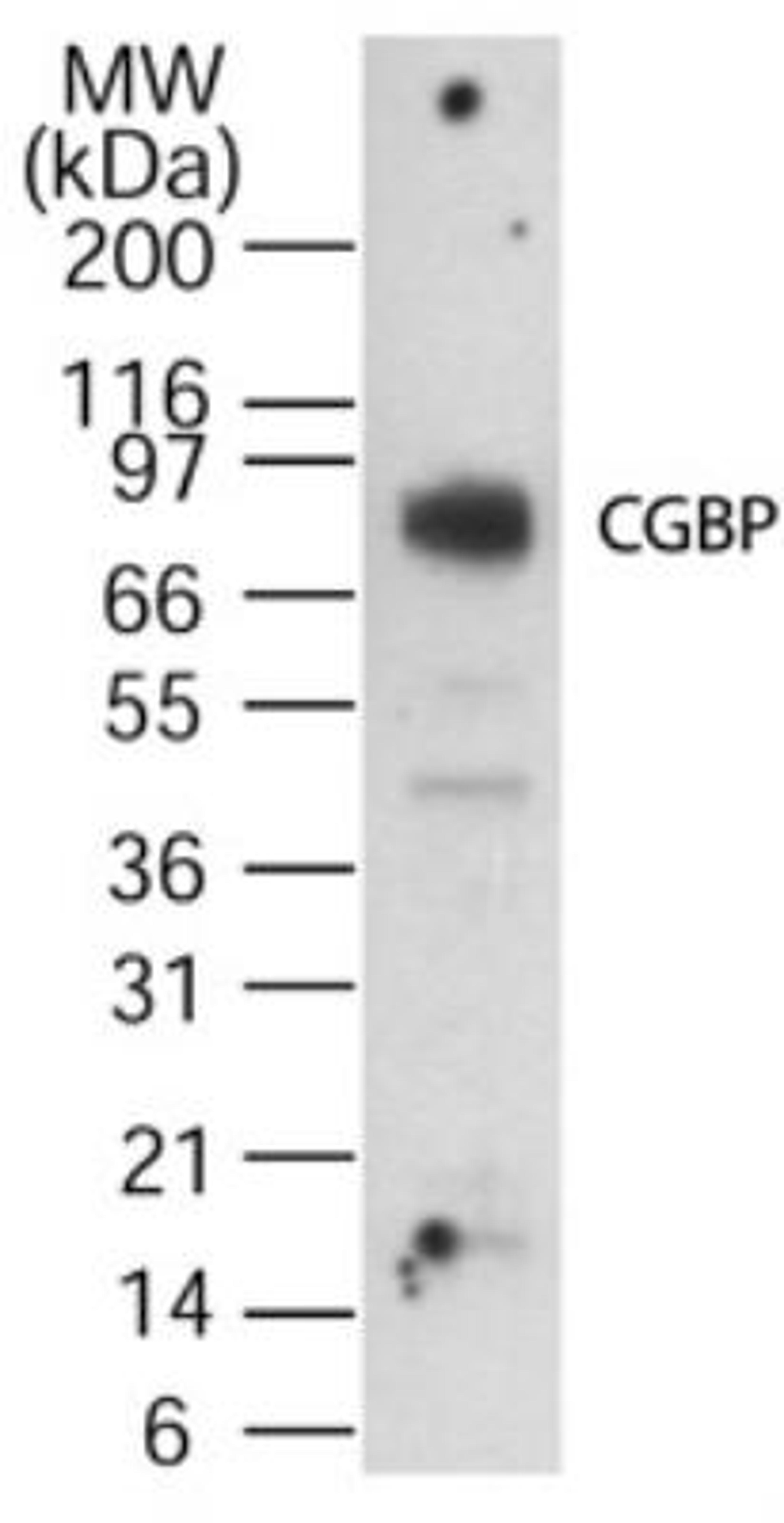 Western Blot: CXXC1 Antibody [NB100-56630] - analysis at 1:1,000 dilution against 15 ug/lane of human spleen lysate. Immunoreactivity was determined using SuperSignal system (Pierce) and by exposing to the film for 15 minutes.