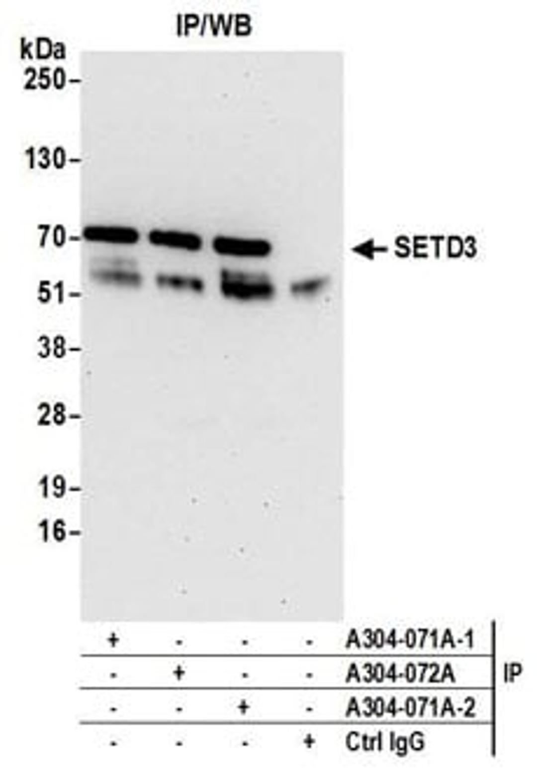 Detection of human SETD3 by western blot of immunoprecipitates.