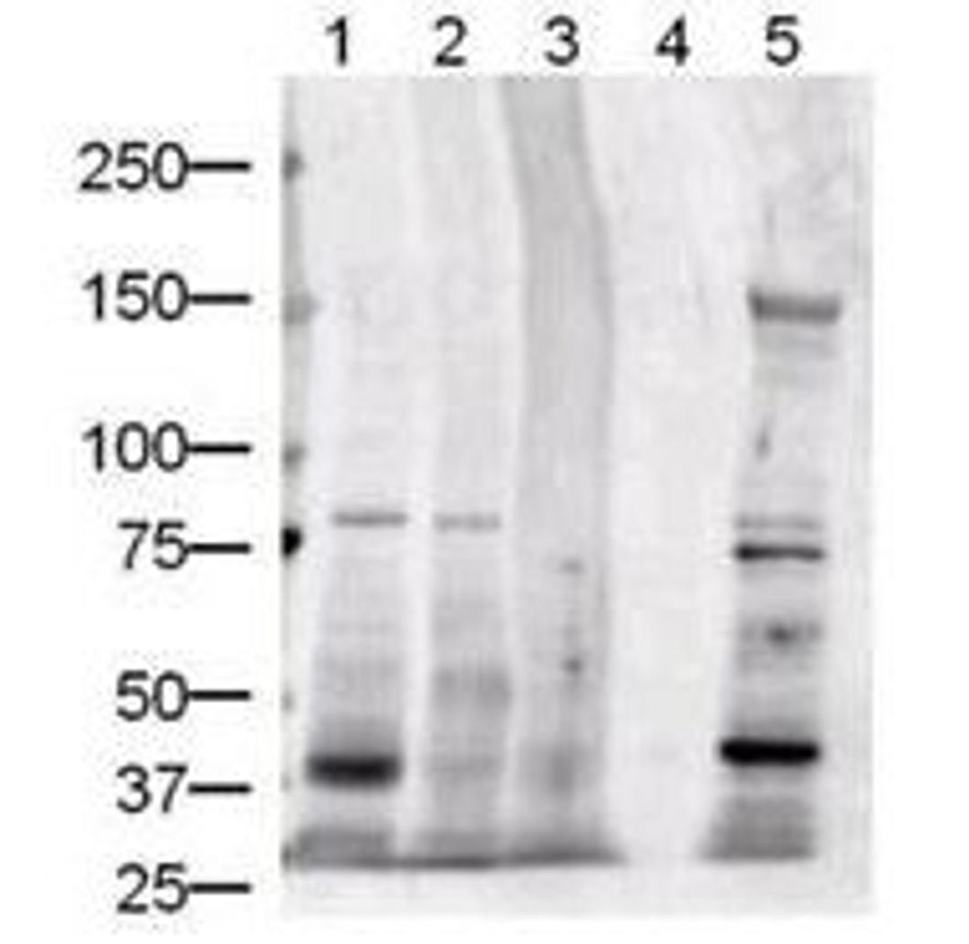 Western blot analysis of various whole cell lysates human brain (lane 1), human kidney (lane 2), human liver (lane 3), and mouse liver (lane 5).