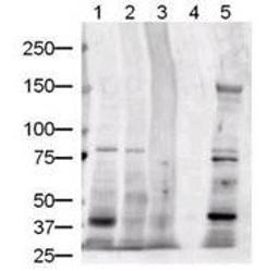 Western blot analysis of various whole cell lysates human brain (lane 1), human kidney (lane 2), human liver (lane 3), and mouse liver (lane 5).