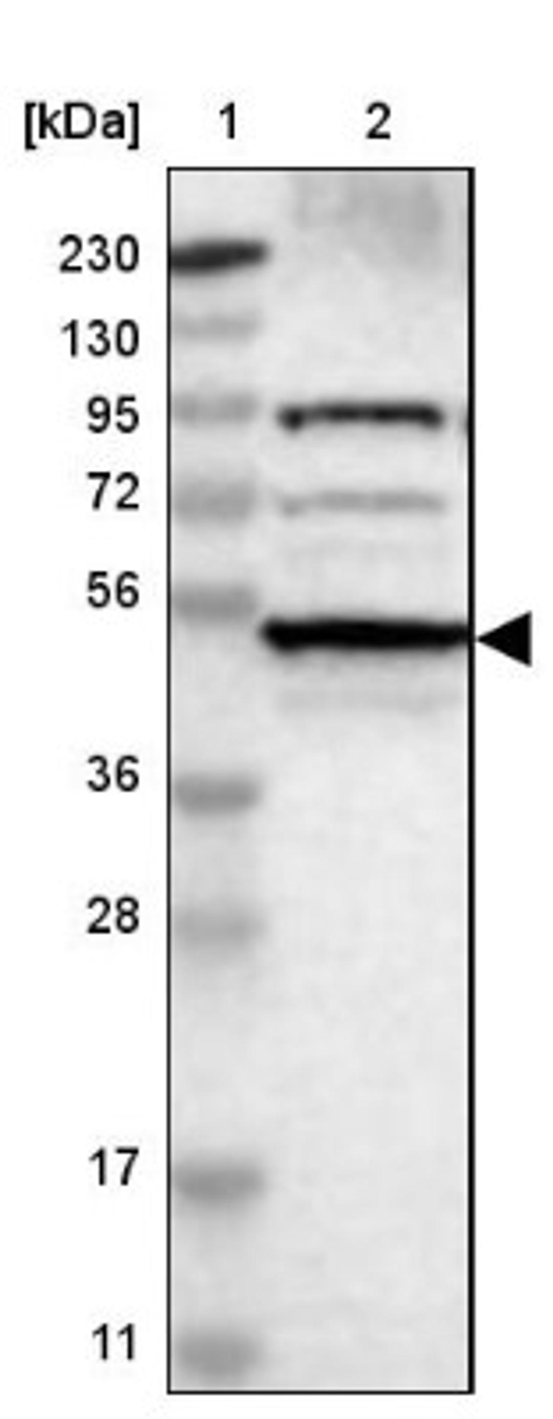 Western Blot: RNF180 Antibody [NBP1-86127] - Lane 1: Marker [kDa] 230, 130, 95, 72, 56, 36, 28, 17, 11<br/>Lane 2: Human cell line RT-4