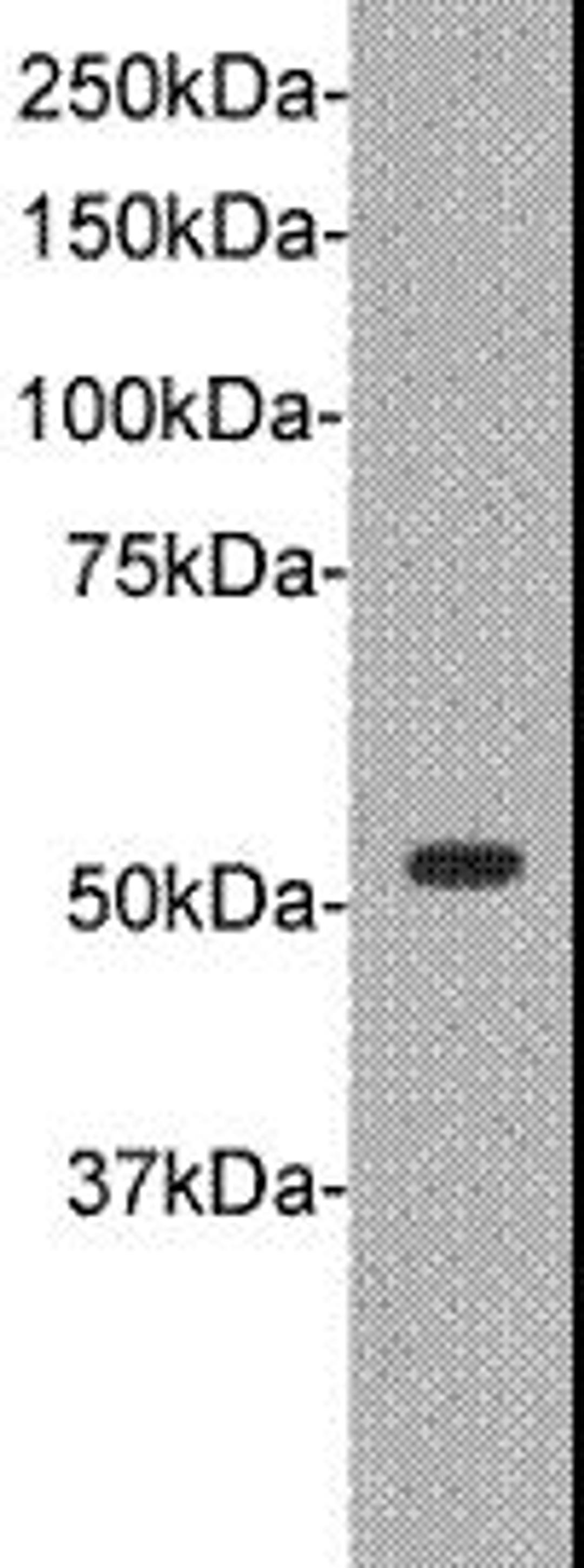 Western blot analysis of A : Jurkat cell using TDT antibody