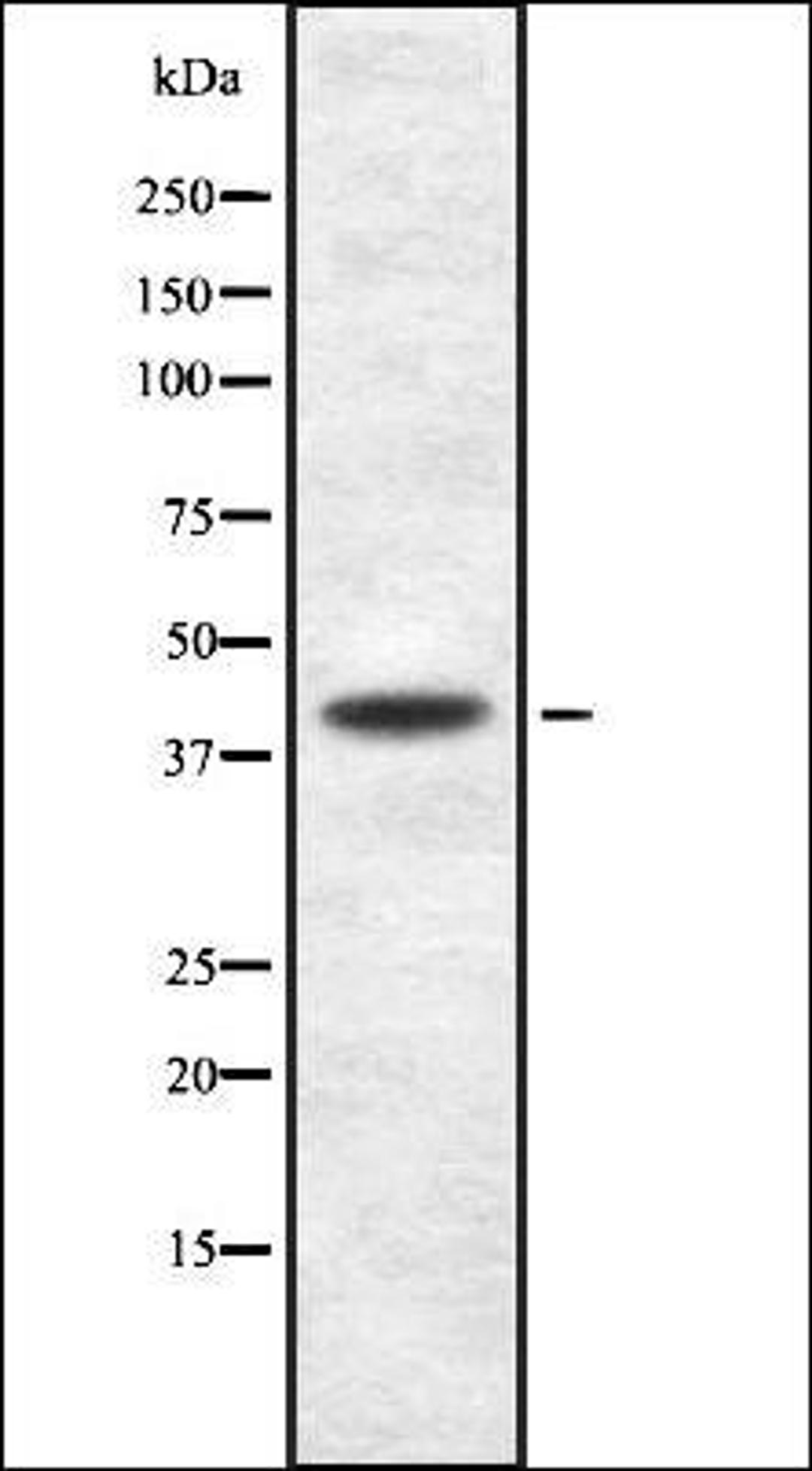 Western blot analysis of HuvEc whole cell lysates using Podocin antibody