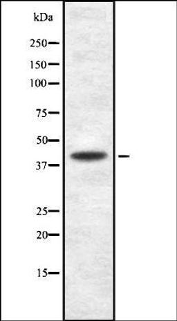 Western blot analysis of HuvEc whole cell lysates using Podocin antibody