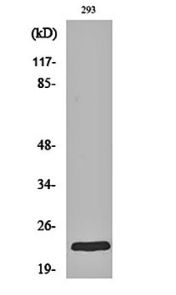 Western blot analysis of 293 cell lysates using Rab 35 antibody