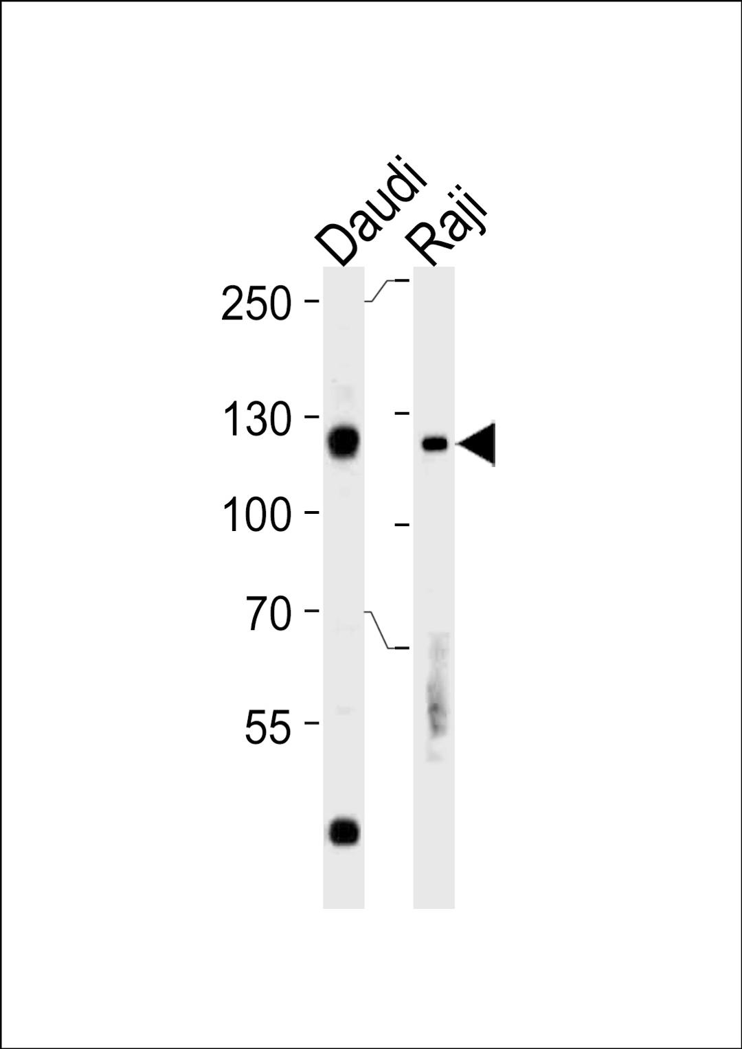 Western blot analysis in Daudi,Raji cell line lysates (35ug/lane).This demonstratdetected the Rb protein (arrow).