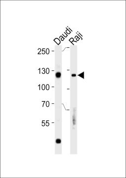 Western blot analysis in Daudi,Raji cell line lysates (35ug/lane).This demonstratdetected the Rb protein (arrow).