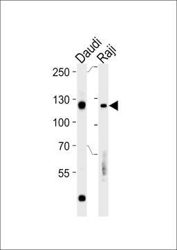 Western blot analysis in Daudi,Raji cell line lysates (35ug/lane).This demonstratdetected the Rb protein (arrow).