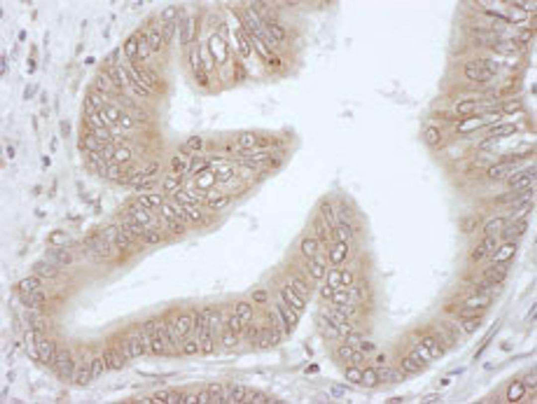 Detection of human 4E-T by immunohistochemistry.