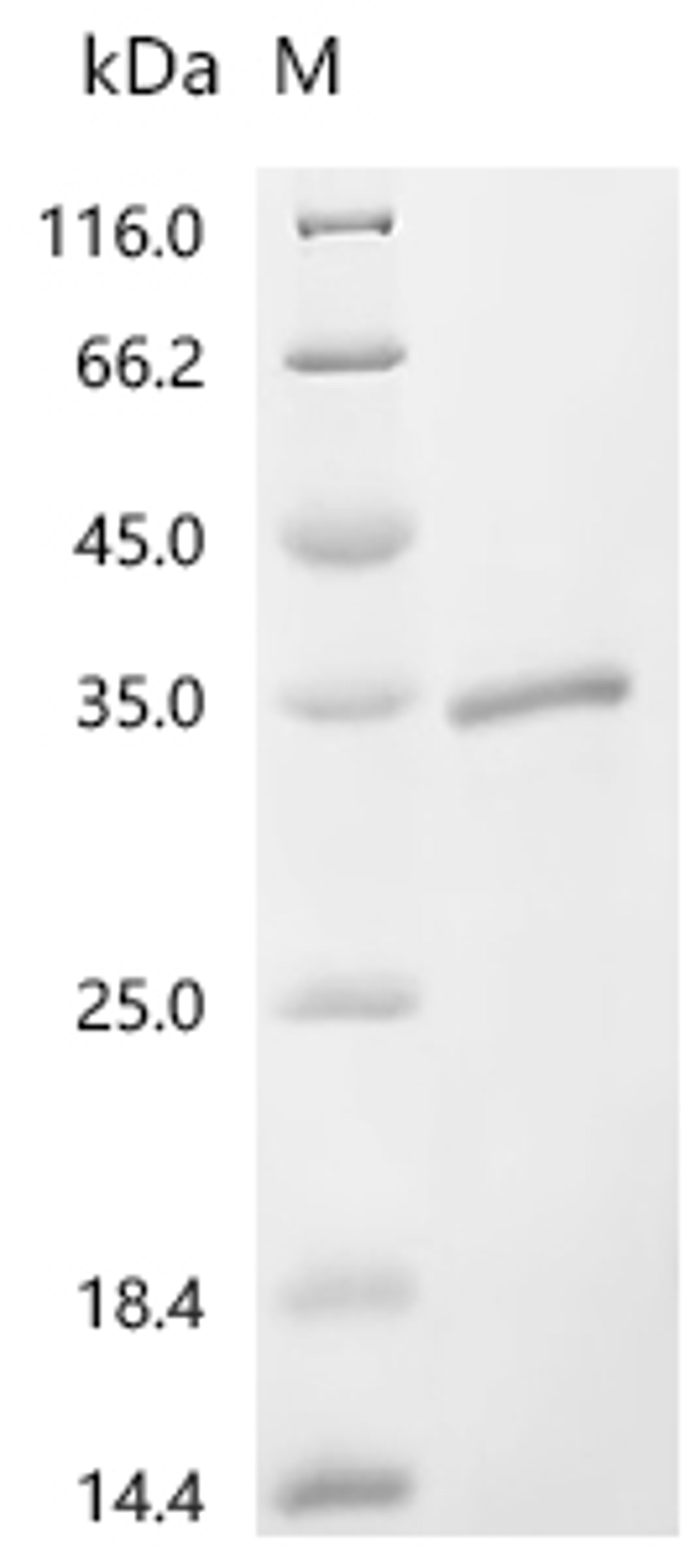 (Tris-Glycine gel) Discontinuous SDS-PAGE (reduced) with 5% enrichment gel and 15% separation gel.