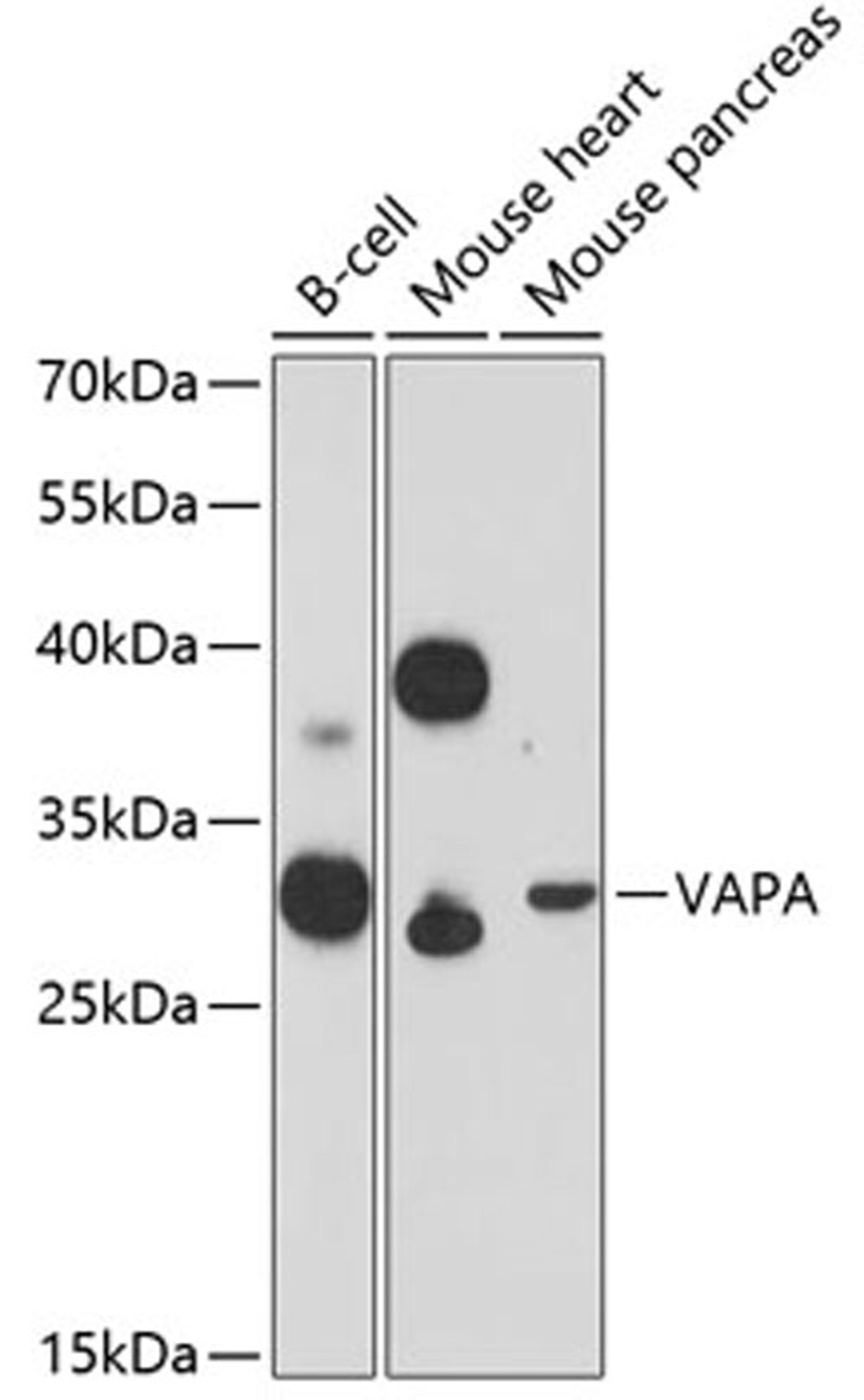 Western blot - VAPA Antibody (A12939)