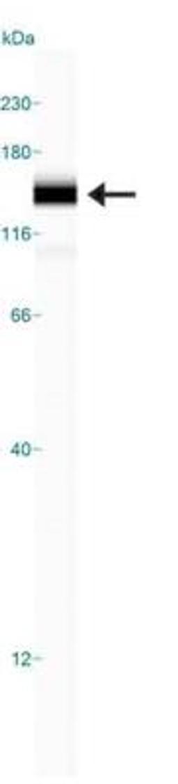 Simple Western: FBXO11 Antibody [NB100-59826] - Simple Western lane view shows a specific band for FBXO11 in 0.5 mg/ml of HeLa lysate.  This experiment was performed under reducing conditions using the 12-230 kDa separation system.