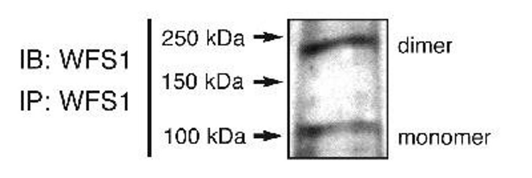 Immunoprecipitation: WFS1 Antibody [NB100-1918] - Visualization of immunoprecipitated WFS1 from INS-1 cells.