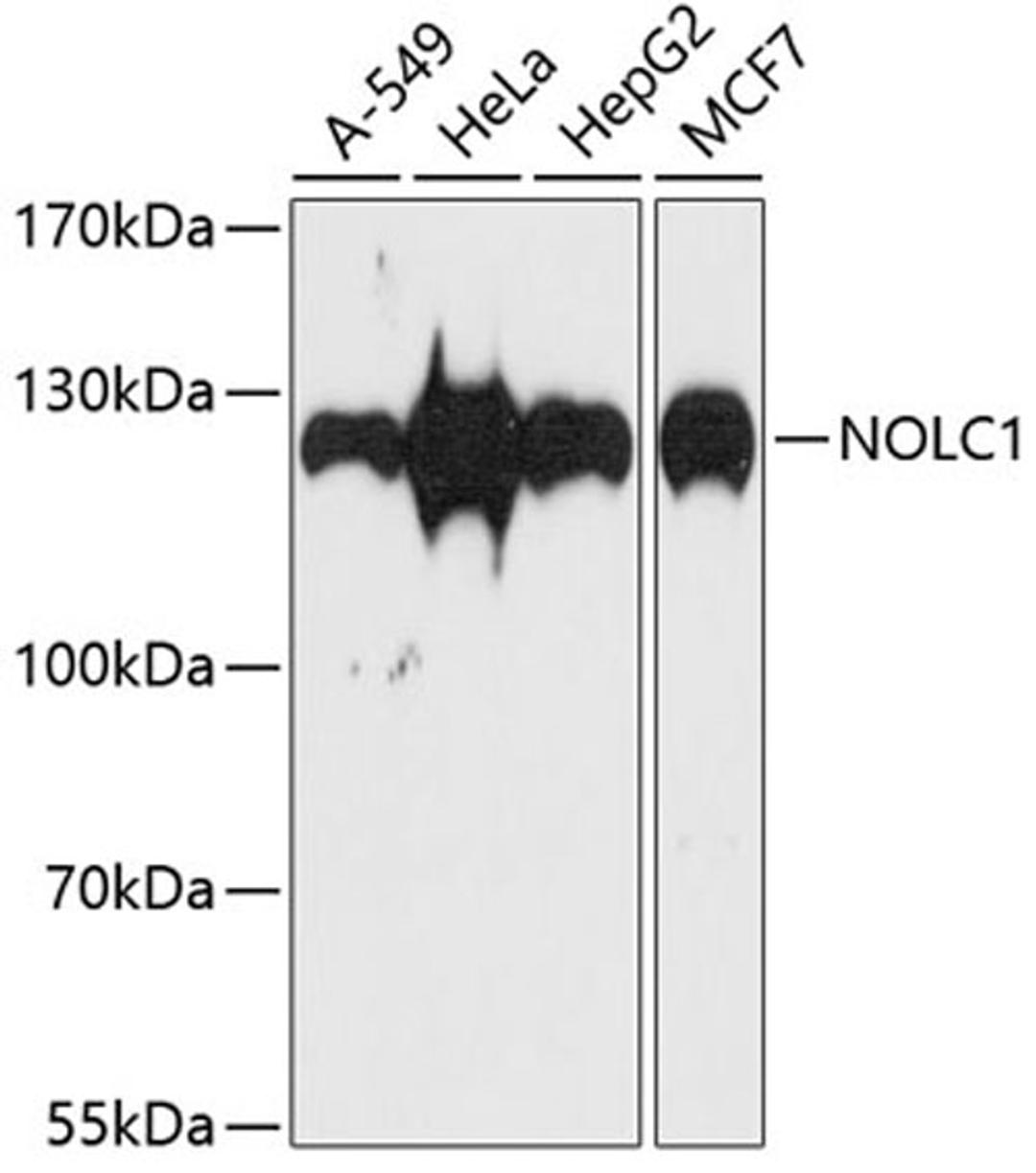 Western blot - NOLC1 antibody (A5899)