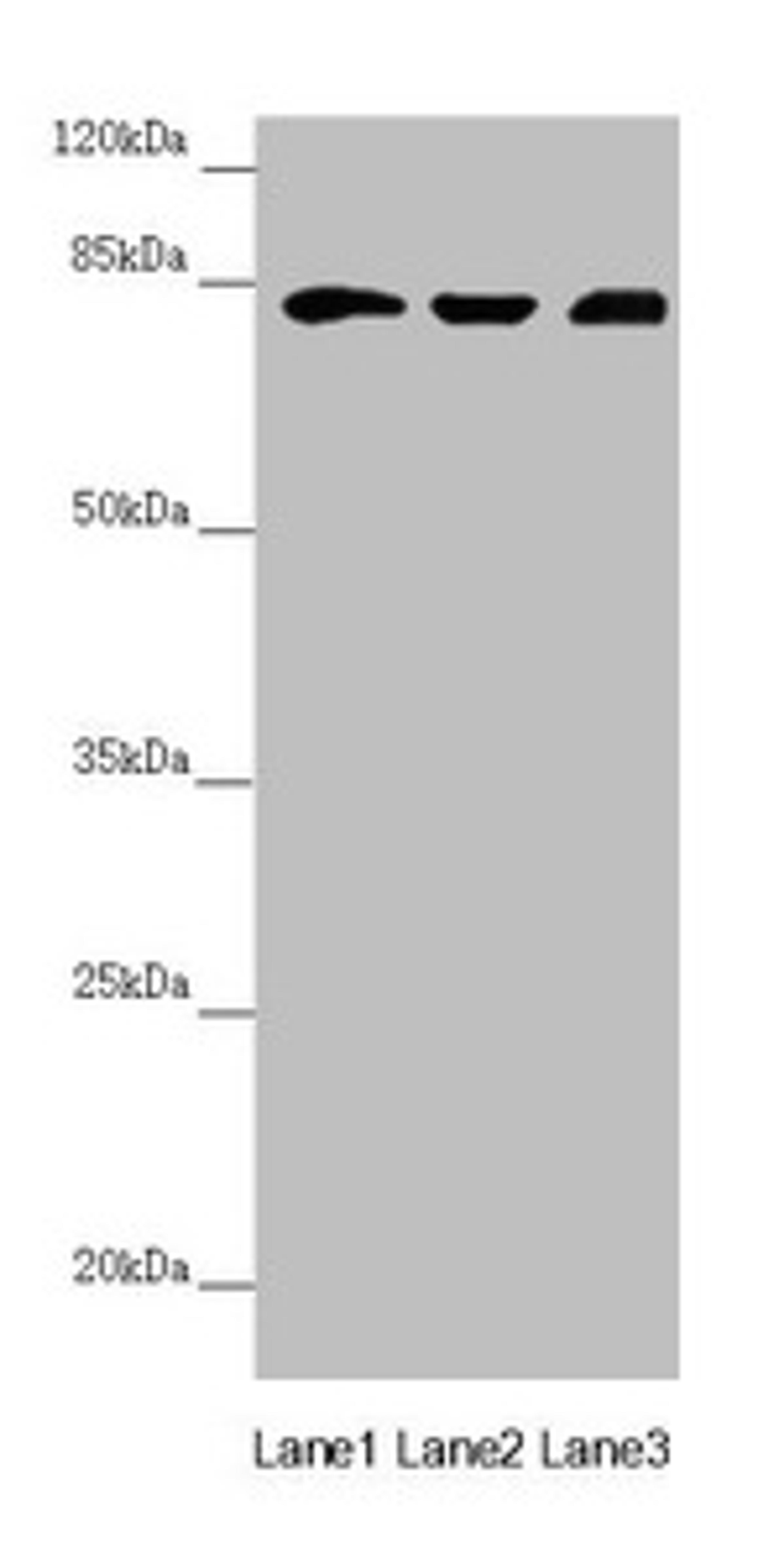 Western blot. All lanes: HOOK2 antibody at 3.91µg/ml. Lane 1: Mouse large intestine tissue. Lane 2: Mouse stomach tissue. Lane 3: A431 whole cell lysate. Secondary. Goat polyclonal to rabbit IgG at 1/10000 dilution. Predicted band size: 83 kDa. Observed band size: 83 kDa
