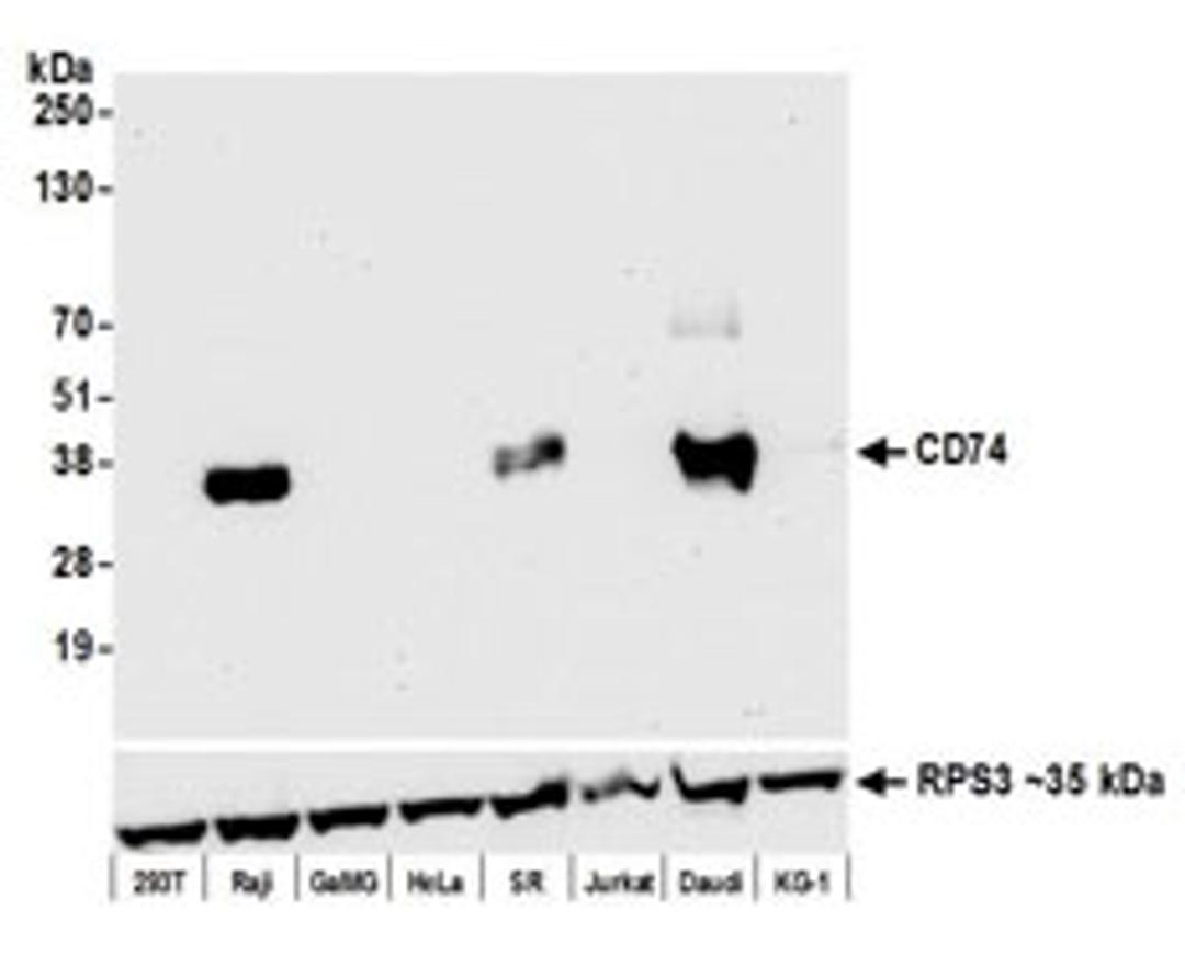 Detection of human CD74 by western blot.