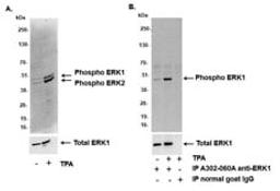 Detection of human phospho-ERK1 and ERK2 by western blot (WB).