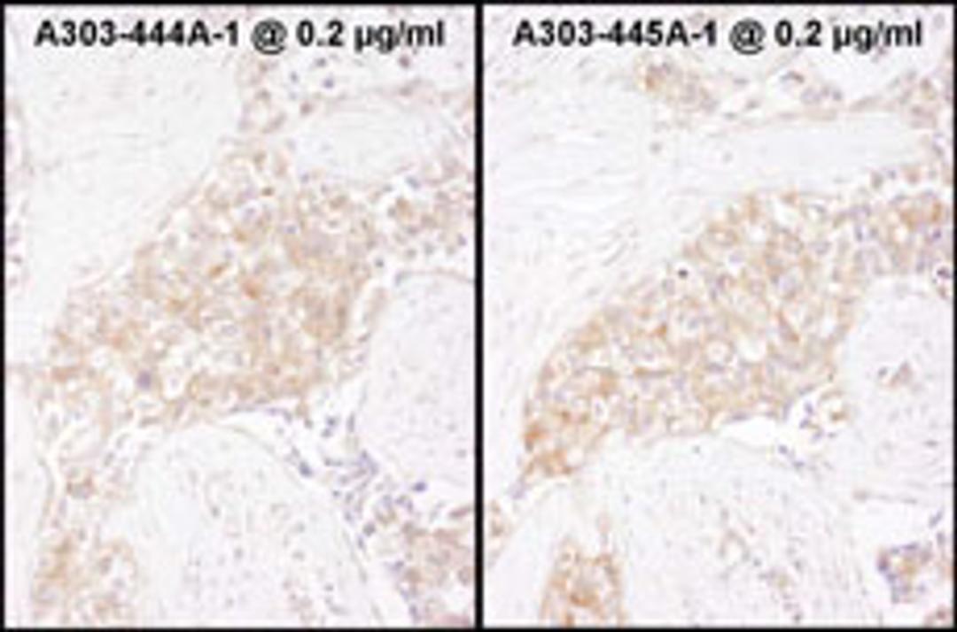 Detection of human TCP1 by immunohistochemistry.