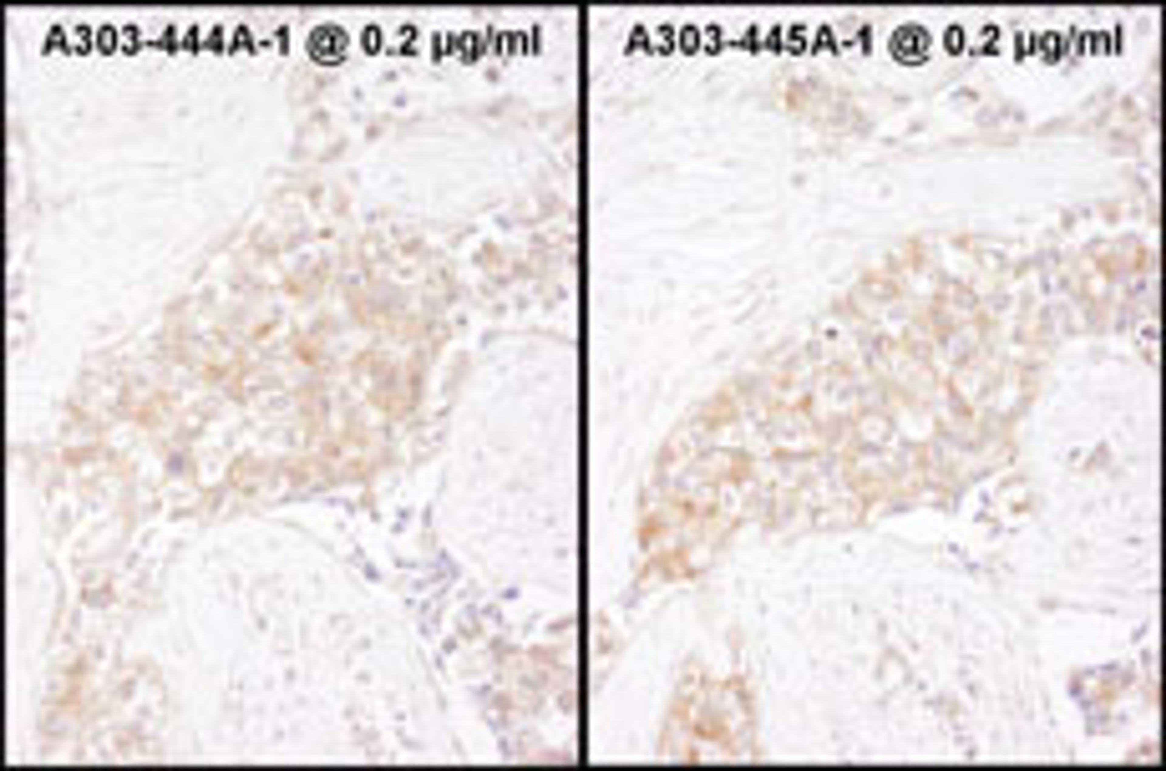 Detection of human TCP1 by immunohistochemistry.