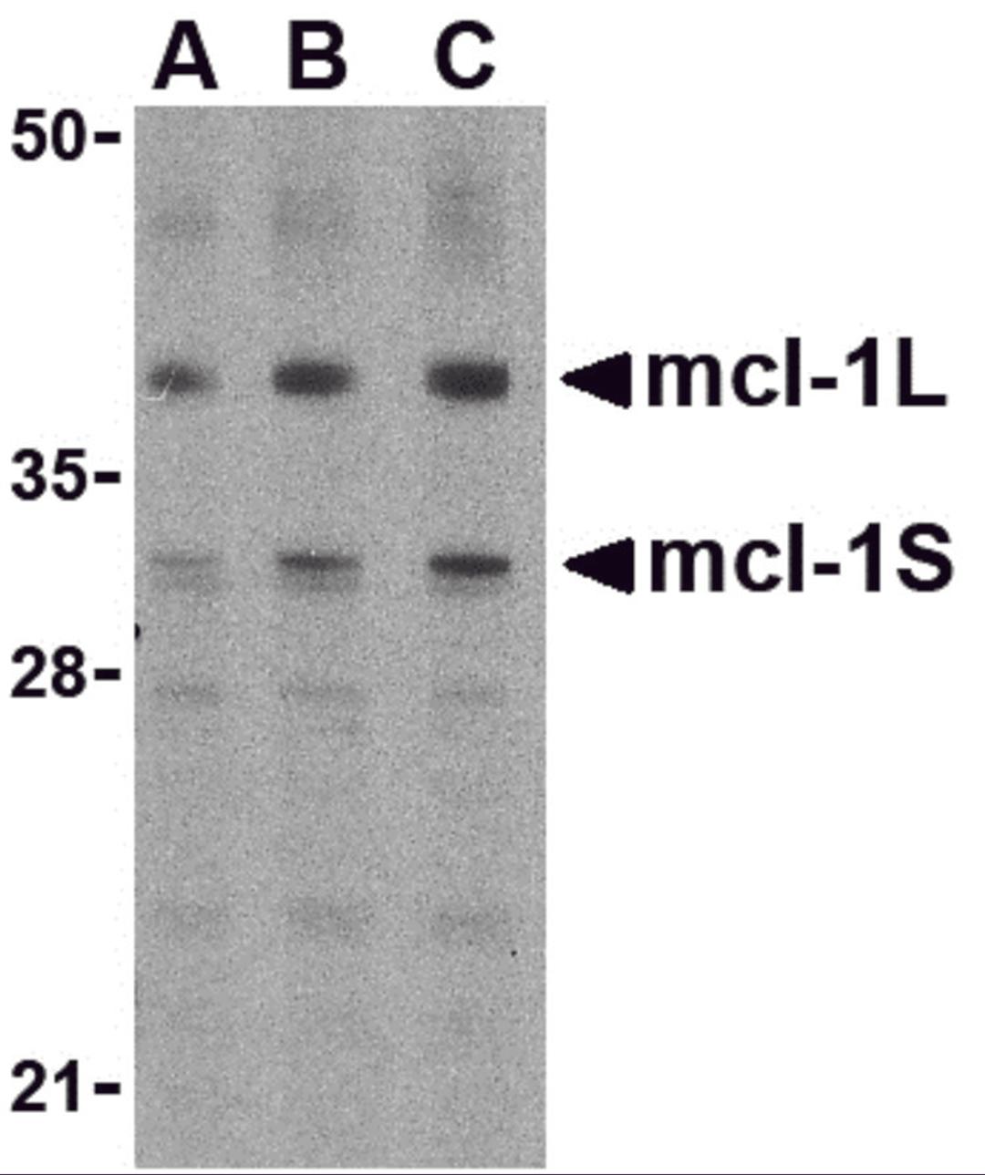 Western blot analysis of Mcl-1 in Raji cell lysates with Mcl-1 antibody (IN) at (A) 0.5, (B) 1, and (C) 2 &#956;g/mL.