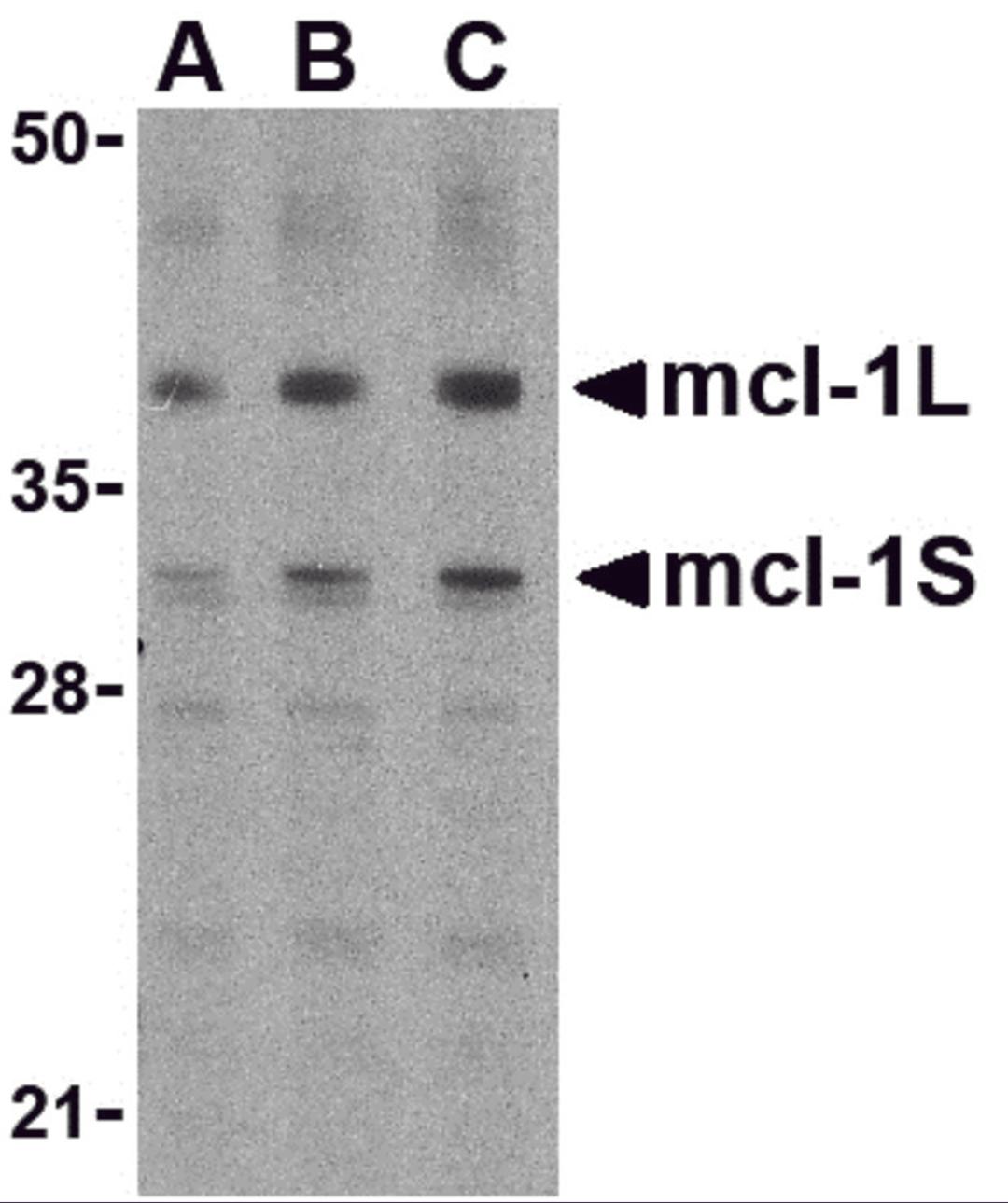 Western blot analysis of Mcl-1 in Raji cell lysates with Mcl-1 antibody (IN) at (A) 0.5, (B) 1, and (C) 2 μg/mL.