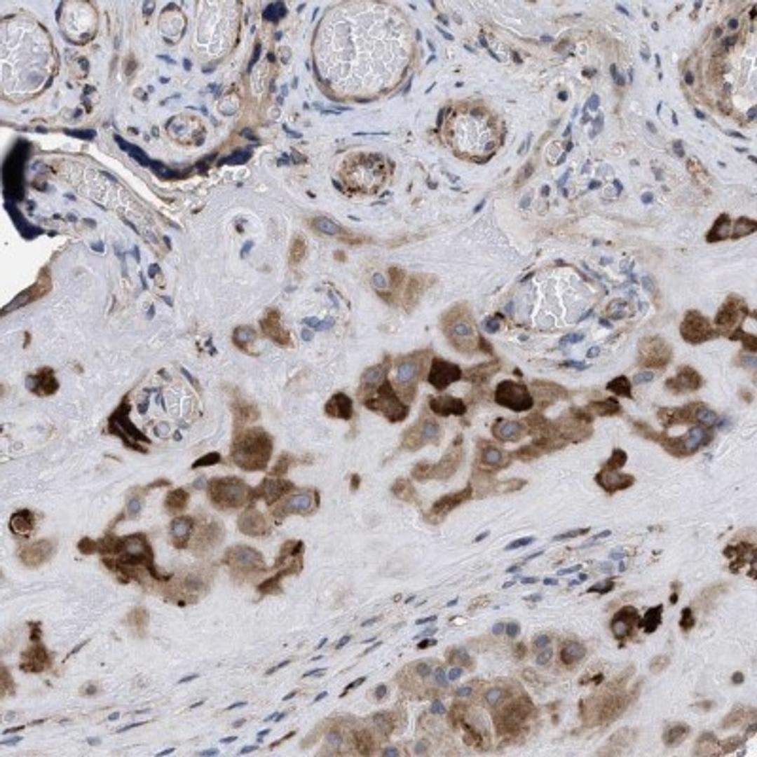 Immunohistochemistry: SQLE Antibody [NBP2-32001] - Staining of human placenta shows strong positivity in Decidual cells.