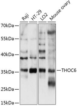 Western blot - THOC6 antibody (A17766)