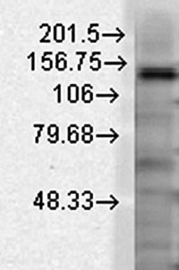 Western blot analysis of rat brain membrane cell lysates using Slo2.2 antibody