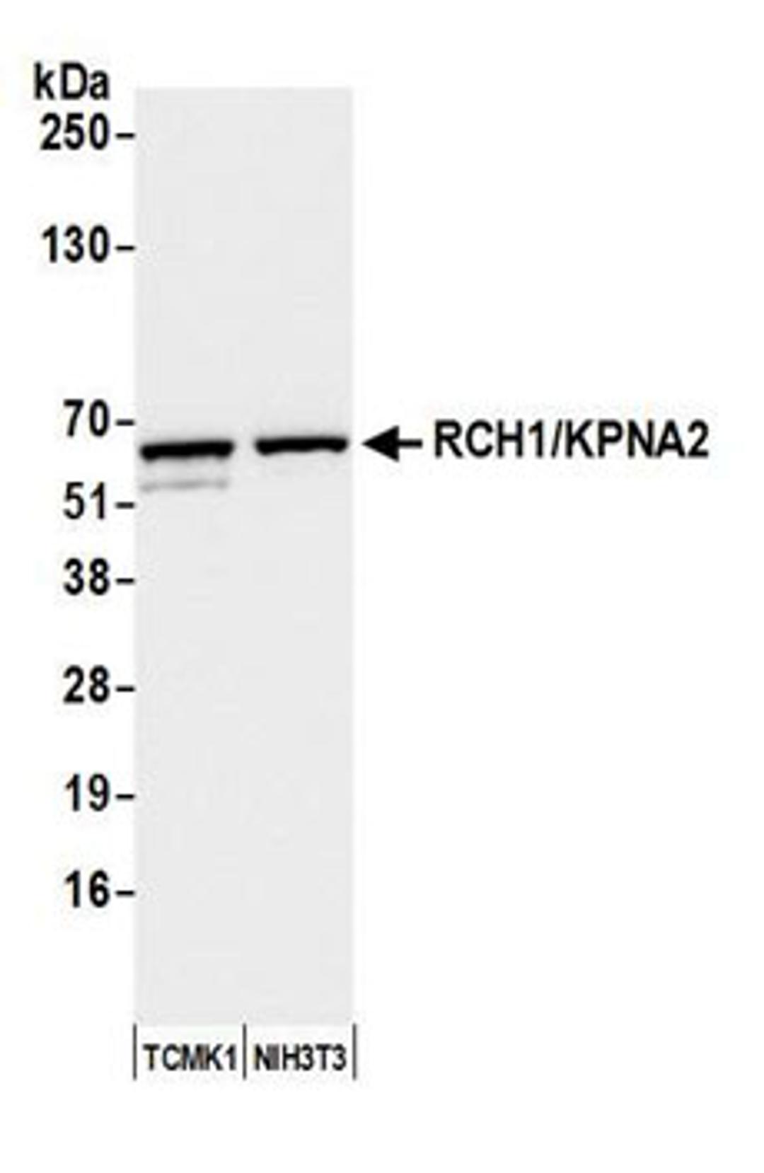 Detection of mouse RCH1/KPNA2 by western blot.