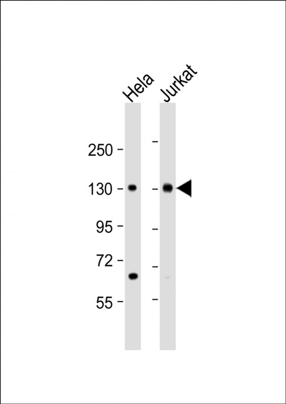 Western Blot at 1:2000 dilution Lane 1: Hela whole cell lysate Lane 2: Jurkat whole cell lysate Lysates/proteins at 20 ug per lane.