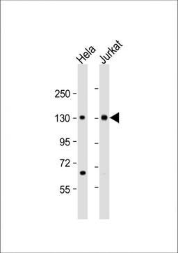 Western Blot at 1:2000 dilution Lane 1: Hela whole cell lysate Lane 2: Jurkat whole cell lysate Lysates/proteins at 20 ug per lane.