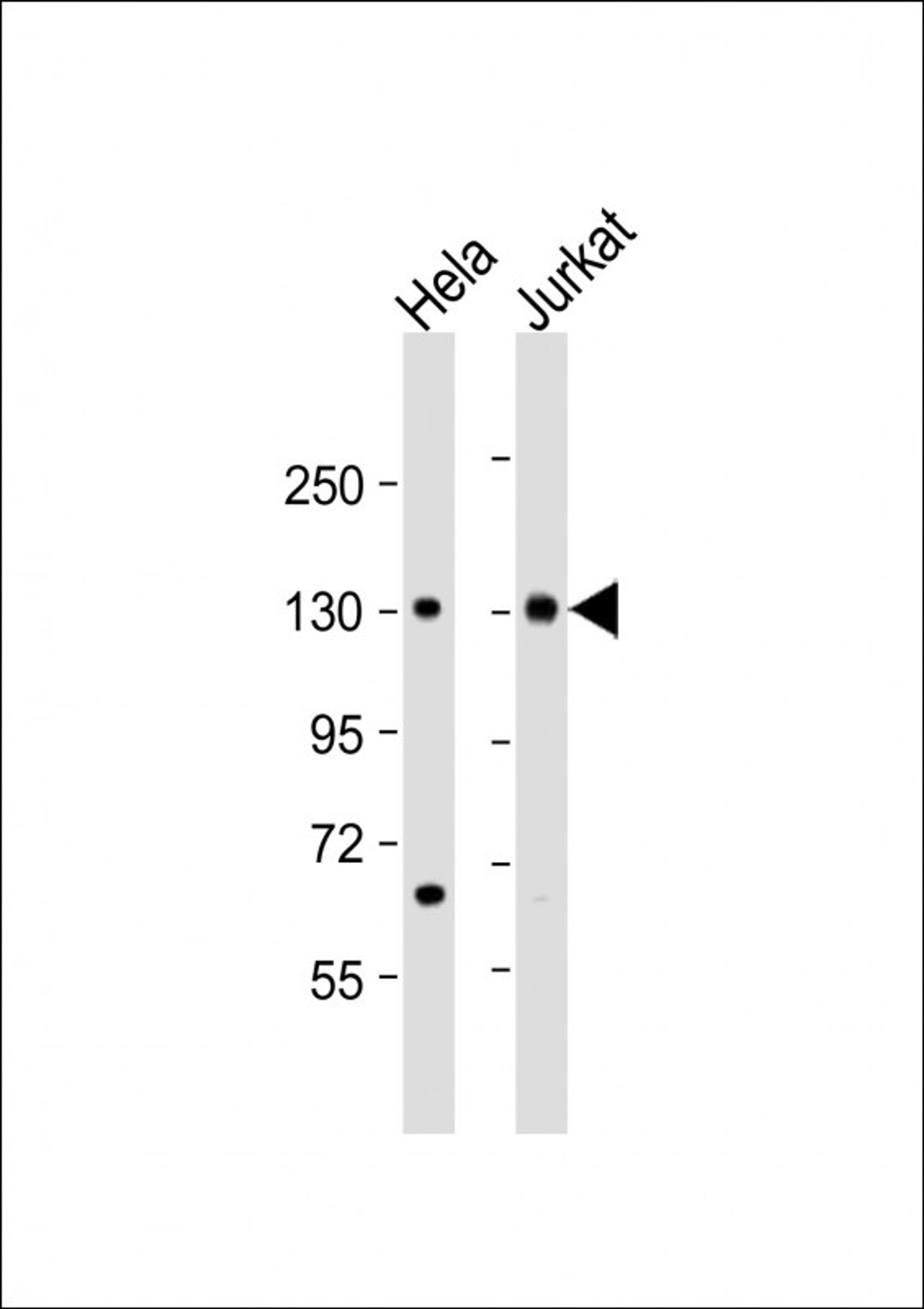 Western Blot at 1:2000 dilution Lane 1: Hela whole cell lysate Lane 2: Jurkat whole cell lysate Lysates/proteins at 20 ug per lane.