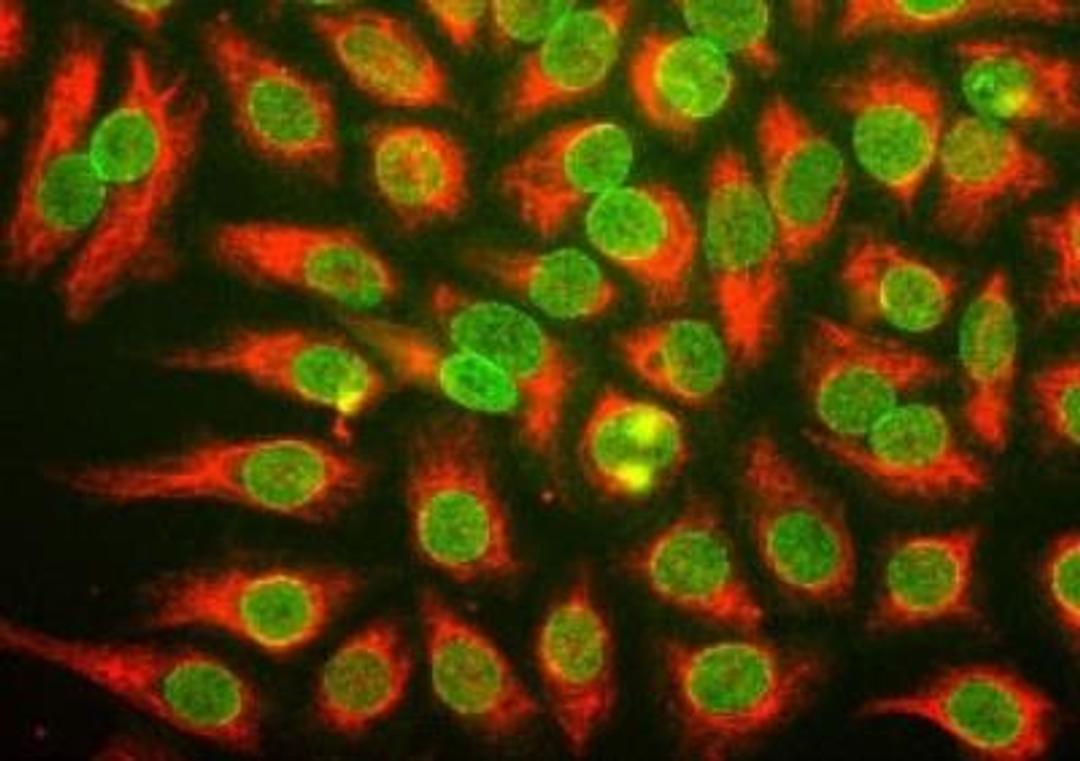 Immunocytochemistry/Immunofluorescence: pan Nuclear Pore Complex Marker Antibody (39C7) [NBP1-05390] - man HeLa cells were stained with monoclonal antibody NBP1-05390, which binds to a nuclear pore complex antigen, and chicken antibody to vimentin NBP1-05425.