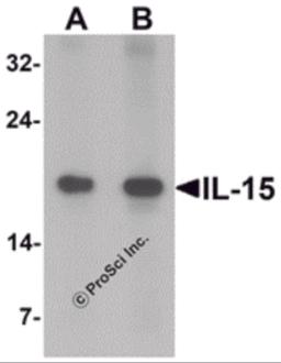 Western blot analysis of IL-15 in rat spleen tissue lysate with IL-15 antibody at (A) 1 and (B) 2 &#956;g/mL