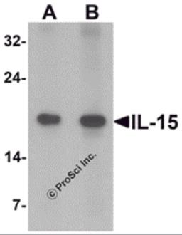Western blot analysis of IL-15 in rat spleen tissue lysate with IL-15 antibody at (A) 1 and (B) 2 μg/mL