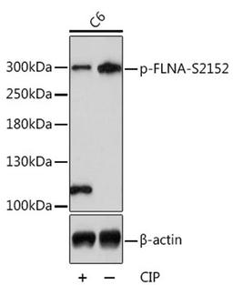 Western blot - Phospho-FLNA-S2152 antibody (AP0783)