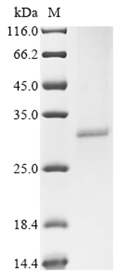 (Tris-Glycine gel) Discontinuous SDS-PAGE (reduced) with 5% enrichment gel and 15% separation gel.