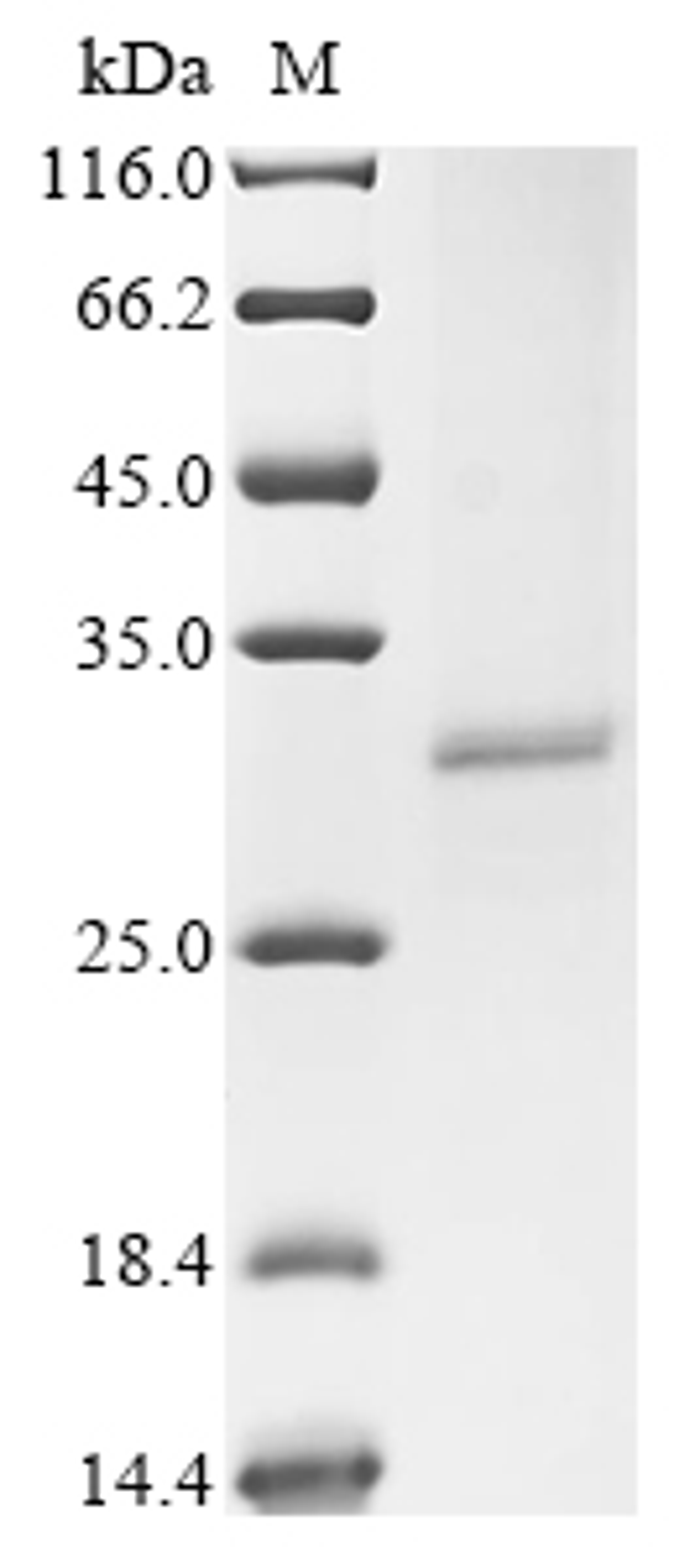 (Tris-Glycine gel) Discontinuous SDS-PAGE (reduced) with 5% enrichment gel and 15% separation gel.