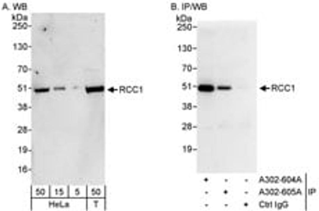 Detection of human RCC1 by western blot and immunoprecipitation.