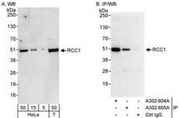 Detection of human RCC1 by western blot and immunoprecipitation.