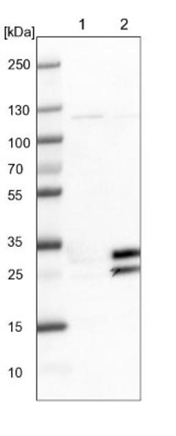 Western Blot: PRAT4B/CNPY4 Antibody [NBP1-81085] - Lane 1: NIH-3T3 cell lysate (Mouse embryonic fibroblast cells)<br/>Lane 2: NBT-II cell lysate (Rat Wistar bladder tumour cells)