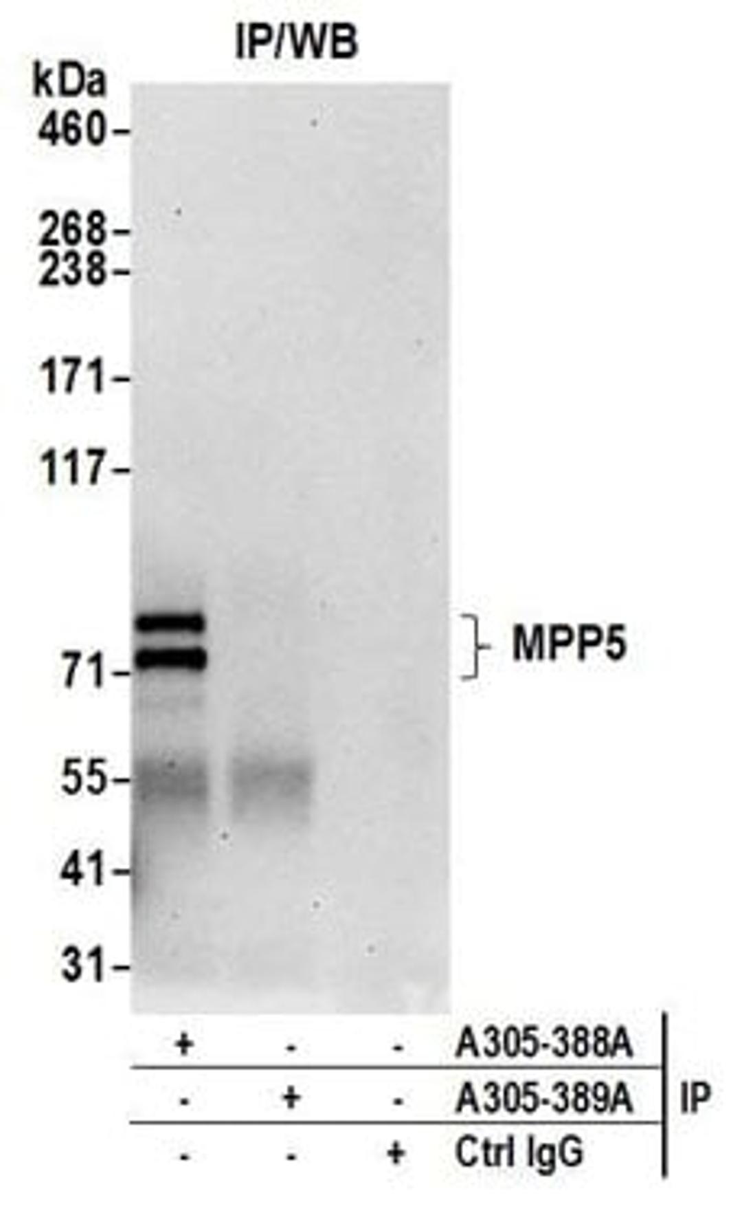 Detection of human MPP5 by western blot of immunoprecipitates.